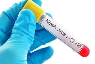 Nipah virus