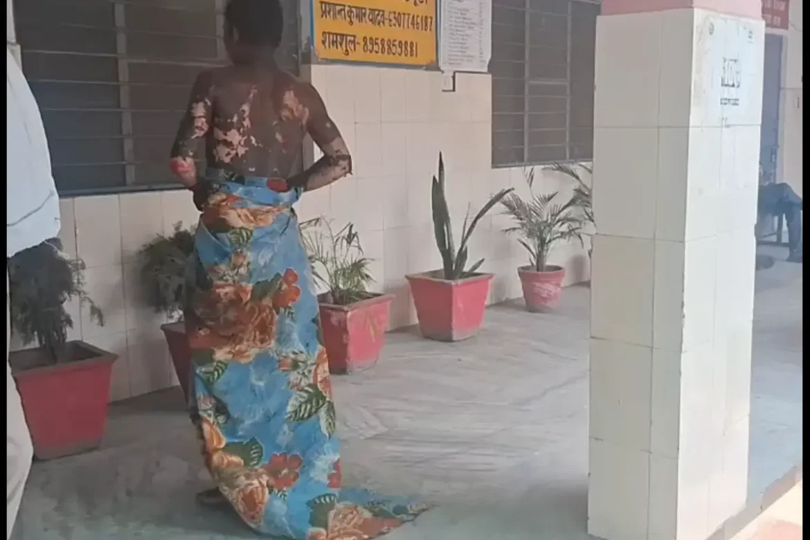 Bareilly जिला अस्पताल में संवेदनहीनता का एक और नमूना, तड़पता रहा 25% से ज्यादा झुलसा युवक